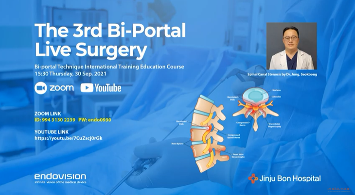 UBE/BIPOTAL LIVE Surgery Dr.Jung